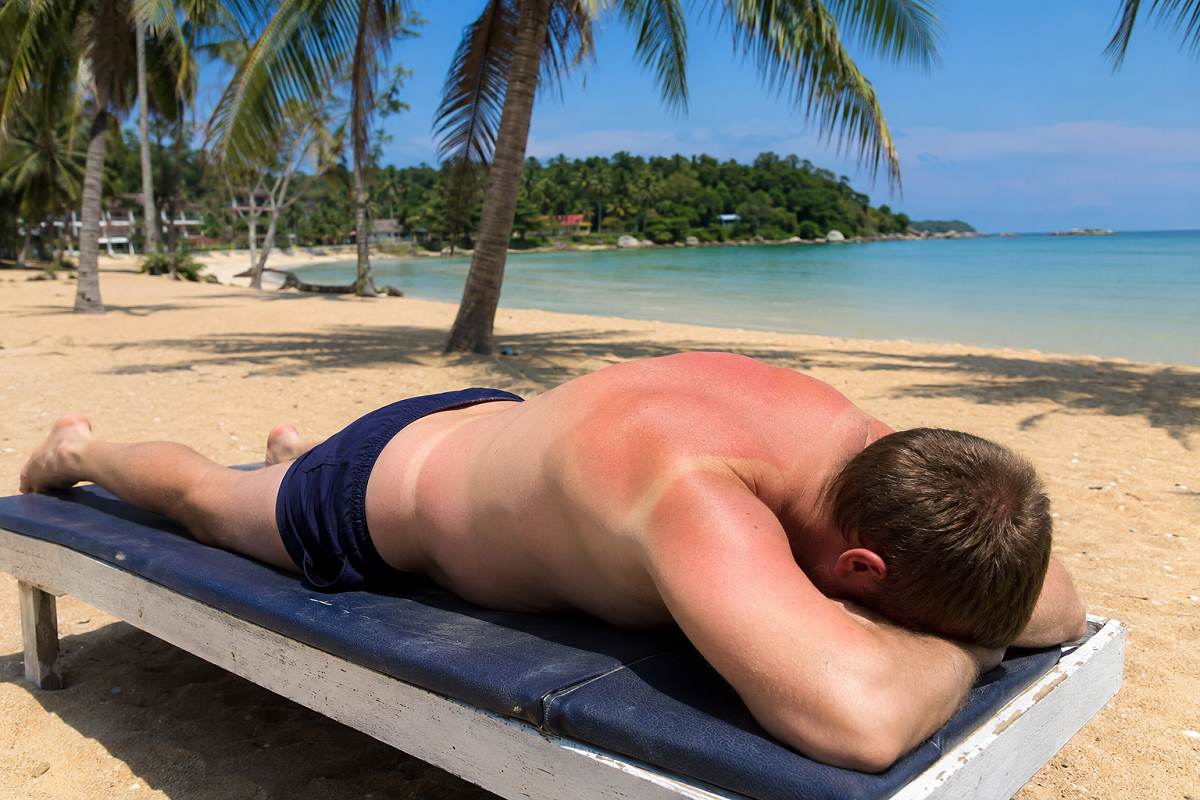 Urlauber mit Sonnenbrand auf einer Liege an einem Strand in Thailand